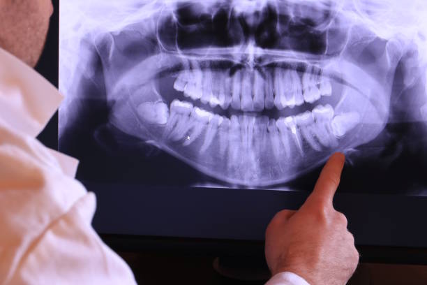 Best Emergency Dental Care for Sports Injuries in Wyong, MI