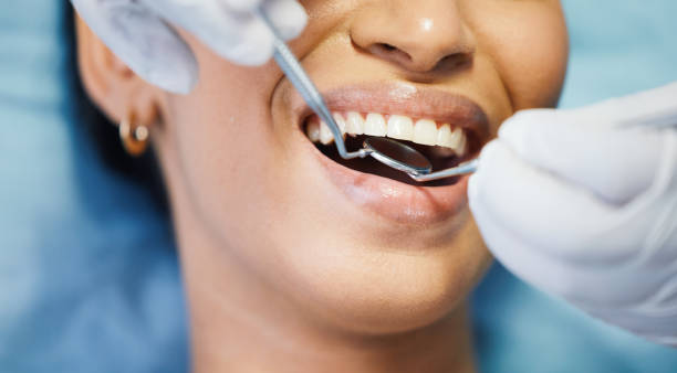 Best Emergency Wisdom Tooth Extraction in Wyong, MI