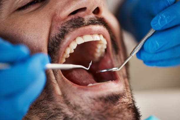 Best Emergency Dental Care for Sports Injuries in Wyong, MI