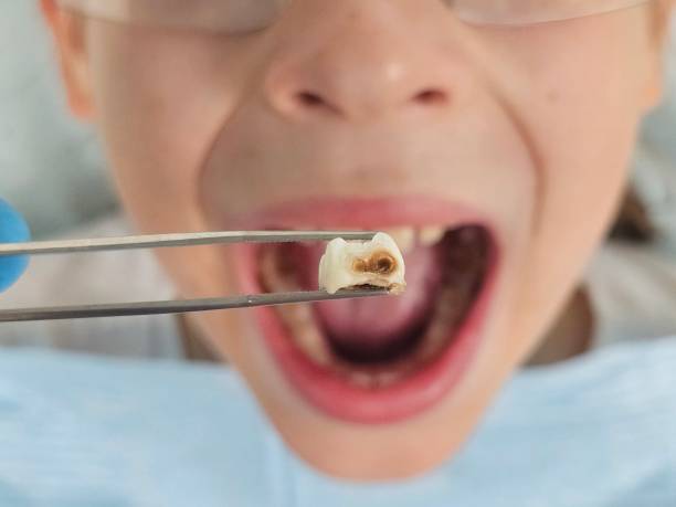 Best 24-Hour Emergency Dental Care in Wyong, MI