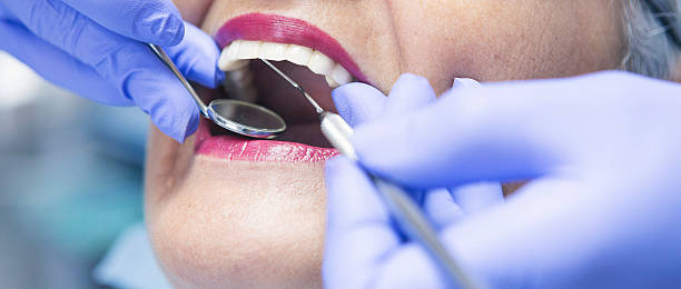 Best Dental Abscess Treatment in Wyong, MI